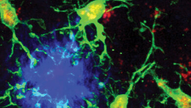 Mikroskopisches Bild mit einer großen blauen Fläche, drum herum drei kleinere Grüne Flächen mit grünen Zweigen..