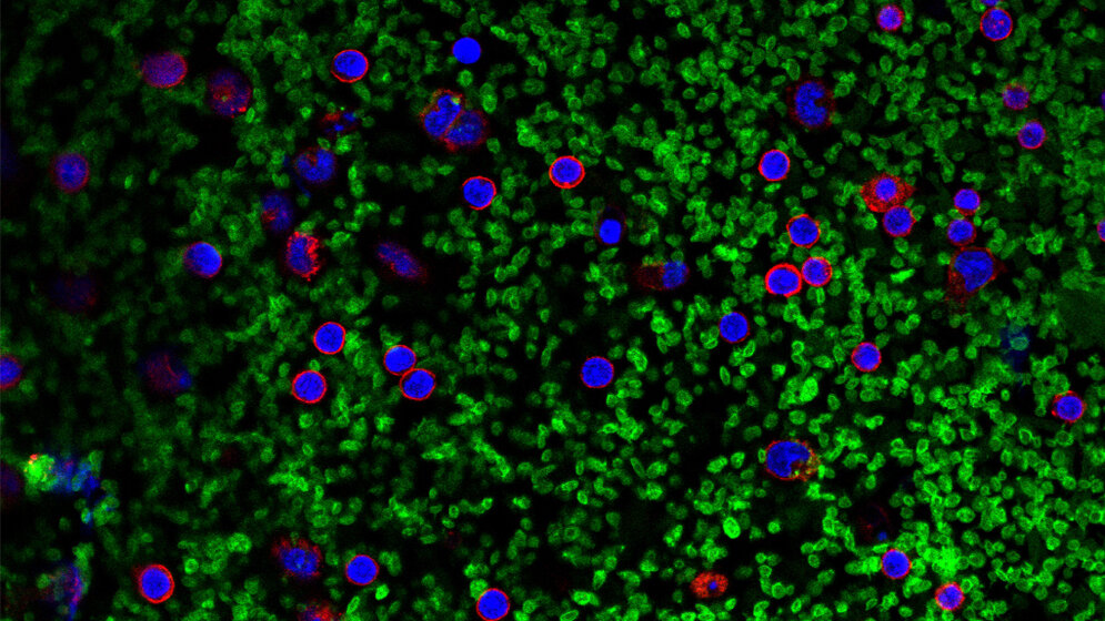 Mikroskopaufnahme: Blutplättchen