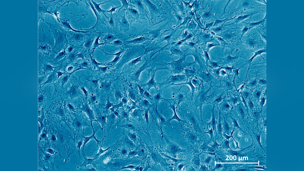 Mikroskopaufnahme_gesunder_Knorpelzellen_Fraunhofer_IWS.jpg Mikroskopaufnahme gesunder Knorpelzellen