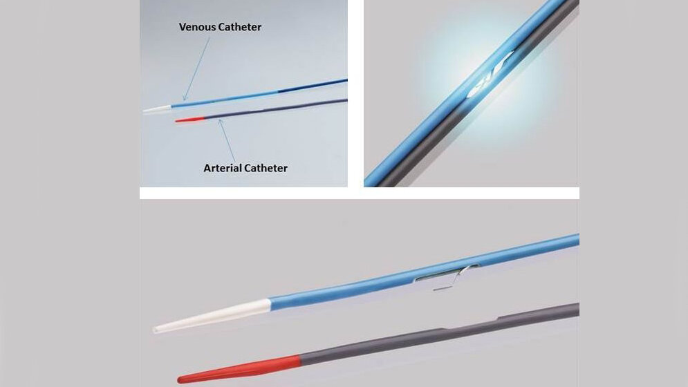 minimalinvasiv ein Dialyseshunt anlegen
