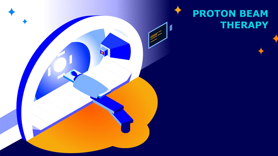 Protonenbestrahlung.jpg Symbolbild für eine Bestrahlung mit Protonen.