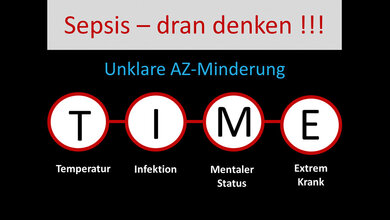 Grafik des TIME-Schemas