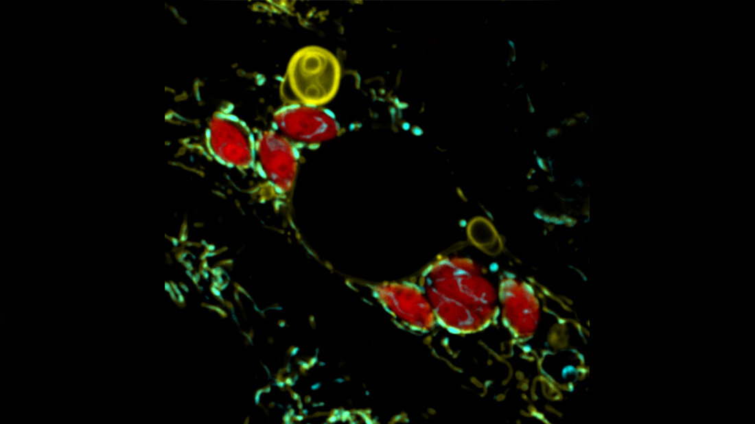 Toxoplasma_gondii_rot__MPI.jpg Parasit Toxoplasma gondii (rot)