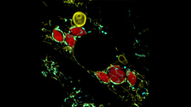 Toxoplasma_gondii_rot__MPI.jpg Parasit Toxoplasma gondii (rot)
