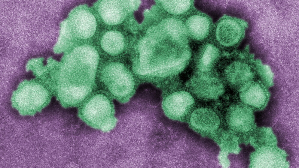 51 epidemische Ausbrüche von Influenza A