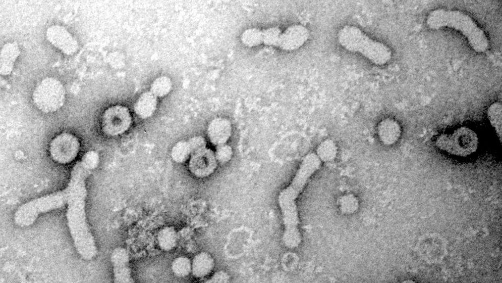 Elektronenmikroskopische Aufnahme von Hepatitis-B-Viren