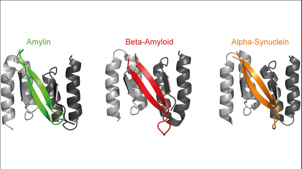 Amylin (grün), Beta-Amyloid (rot) und Alpha-Synuclein