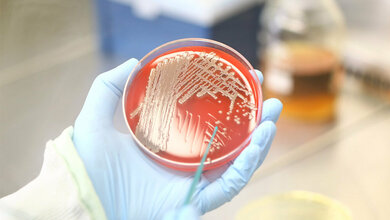 Staphylokokken-Kolonien