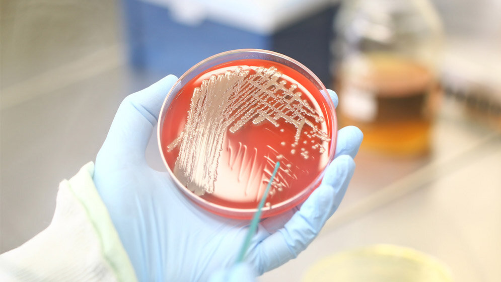 Staphylokokken-Kolonien