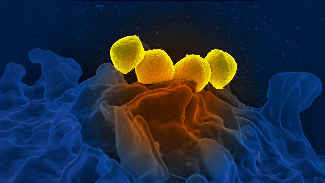 Aufnahmen gelb gefärbter  Streptokokken der Gruppe A (GAS), Streptococcus ­pyogenes