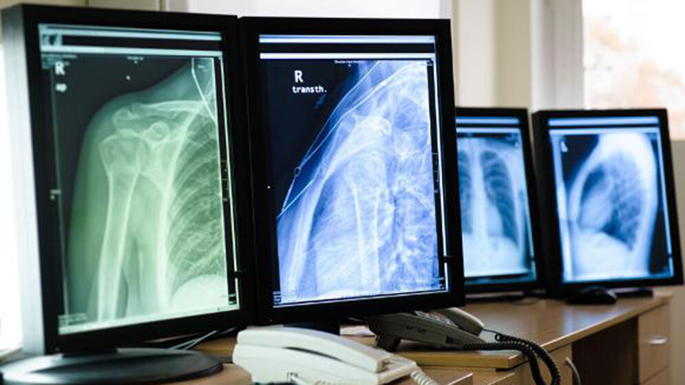 Belichtungspunktesystem