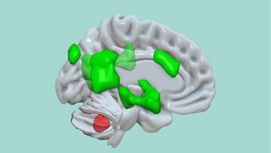 Kleinhirn.jpg Kleinhirn im Netzwerk