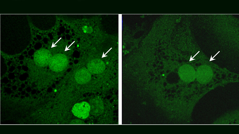 Akkumulation_eines_Glucosesensors_M_Schupp.jpg Akkumulation eines Glucosesensors
