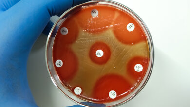 Titelbild_Abb1_AdobeStock_431190739.jpg Antibiogramm