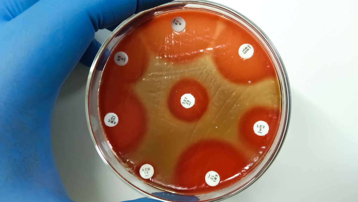 Titelbild_Abb1_AdobeStock_431190739.jpg Antibiogramm