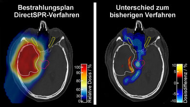 Vorteil der höheren Präzision und verkleinerten Reichweite-Unsicherheit
