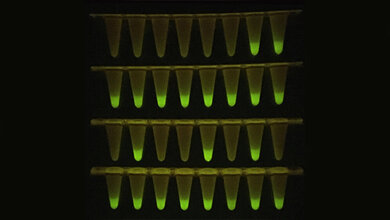Die_vor_einem_LED_Schirm_fluoreszierenden_Proben_zeigen_Anwesenheit_von_SARS_CoV_2.jpg Die vor einem LED-Schirm fluoreszierenden Proben