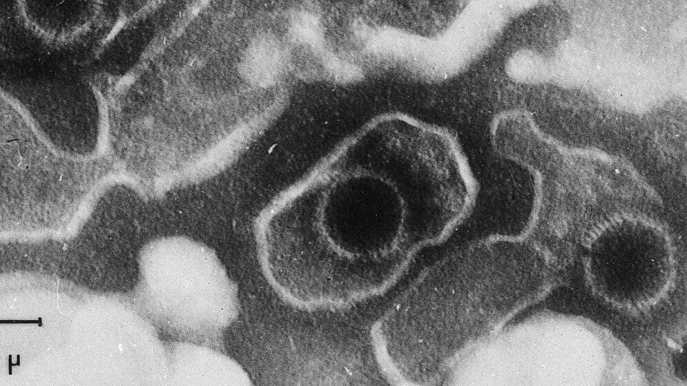 Epstein-Barr-Virus