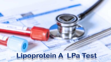 Lp (a)-Wert einmal im Leben bestimmen lassen