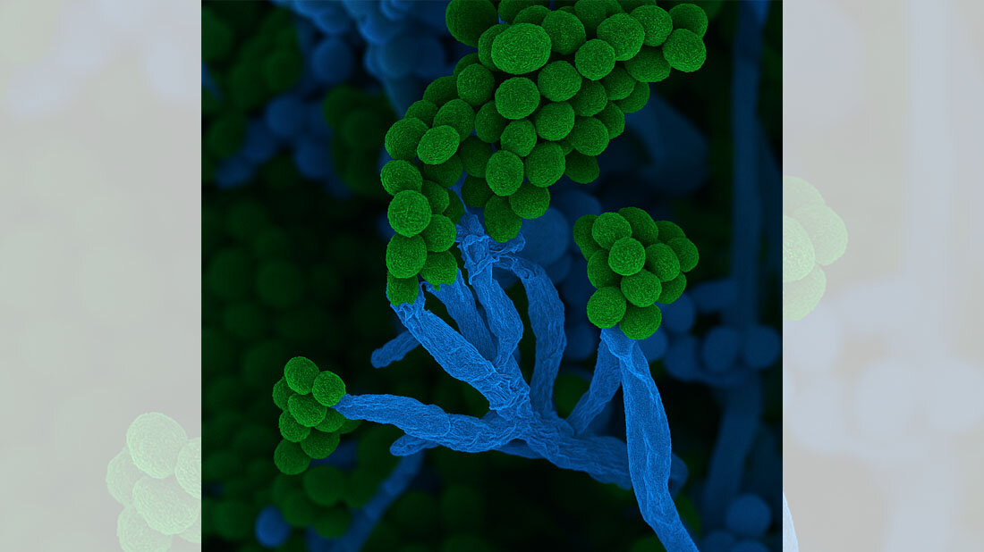 Penicillium.jpg Rasterelektronenmikroskopische Aufnahme von Penicillium, rund 5000fach vergrößert, nachträglich eingefärbt, Zellketten mit Sporen am Ende sind zu sehen.