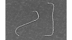 Weil-Krankheit – meldepflichtige Leptospirose