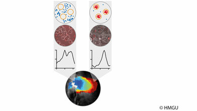 Veränderung des optoakustischen Signals phototropher Bakterien