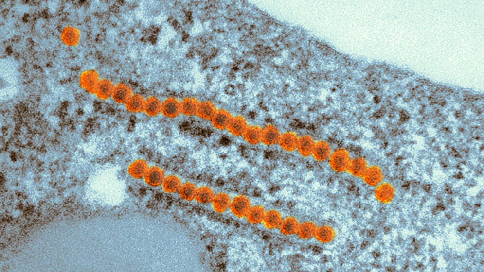 Elektronenmikroskopische_Aufnahme_des_Zikavirus_rot_in_einer_Labor_Zelllinie_K_Boller_PEI.jpg Zikavirus