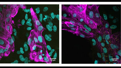Kultivierte humane Herzmuskelzellen