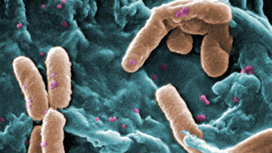 Pseudomonas aeruginosa 