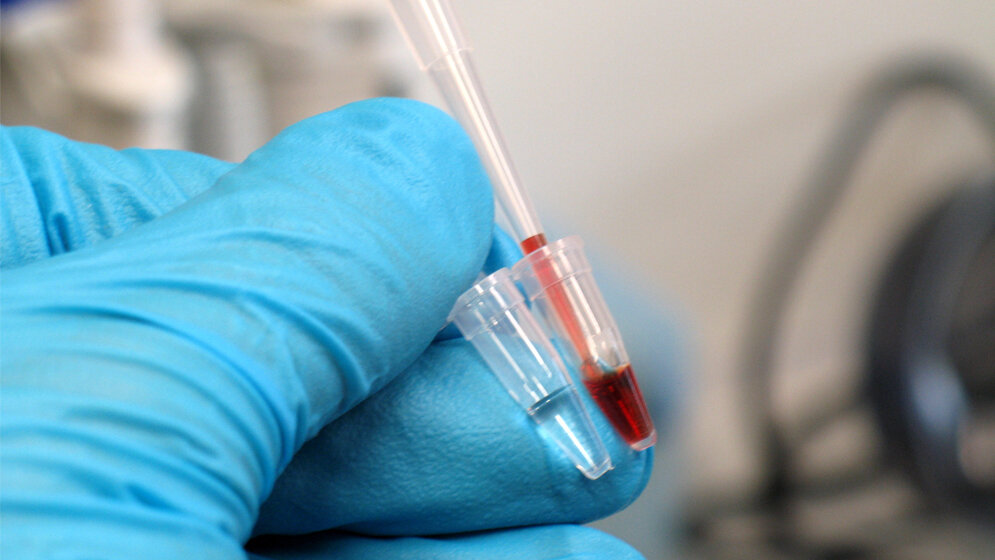 Meerrettich-Peroxidase