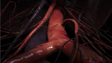 Aorta_www_scientificanimations_com_CC_BY_SA_4_0_via_Wikimedia_Commons.jpg Aorta
