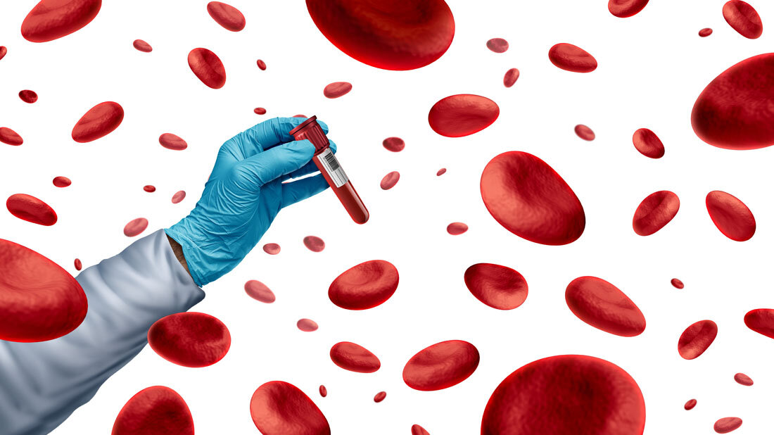 Symbolbild für Hämatologie