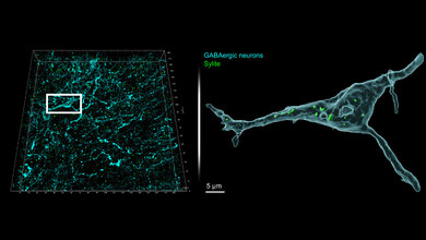 Sylite_Faerbung.jpg Sylite-Färbung (grün) eines Mittelhirnschnitts