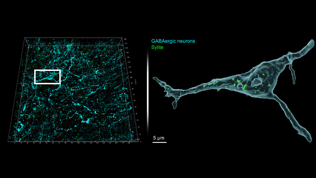 Sylite_Faerbung.jpg Sylite-Färbung (grün) eines Mittelhirnschnitts