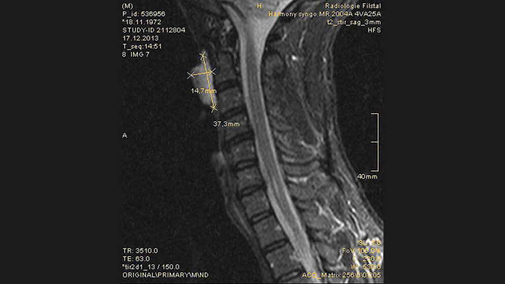 Schnittbilddiagnostik der Wirbelsäule (7.18)