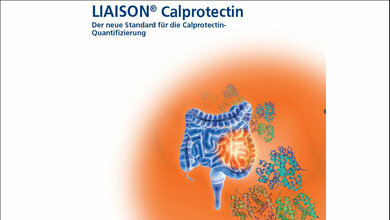 Messung von Calprotectin