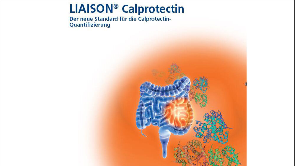Messung von Calprotectin