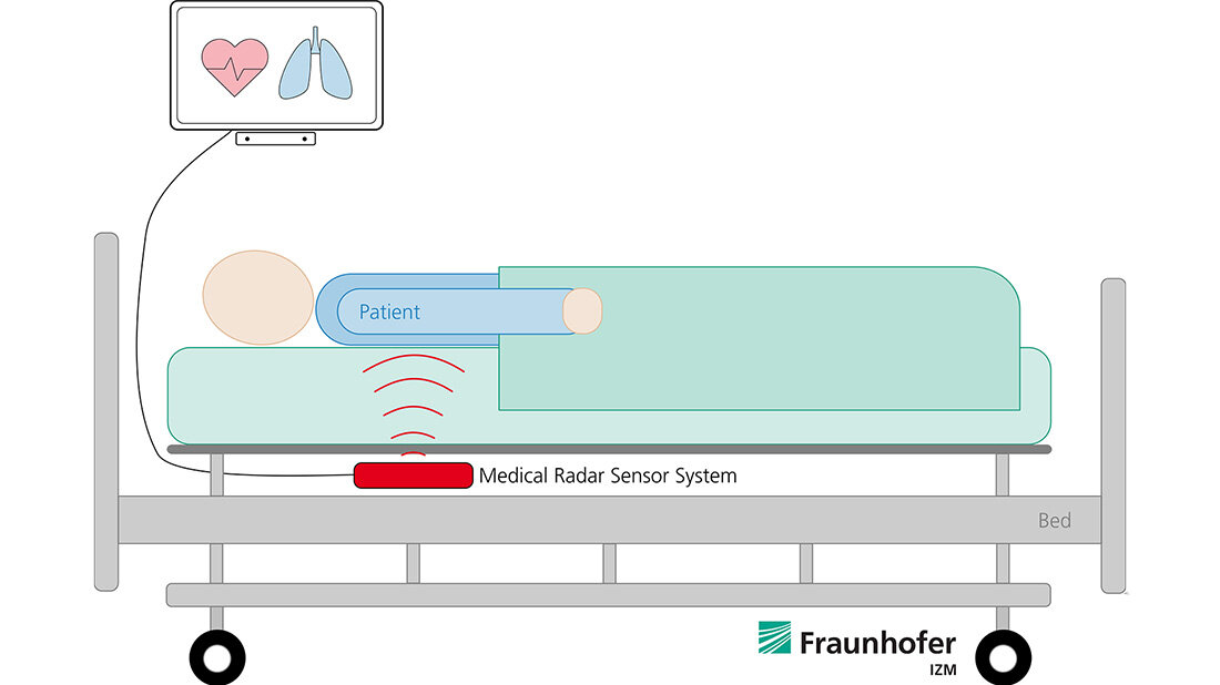 EKG_radar.jpg EKG radar