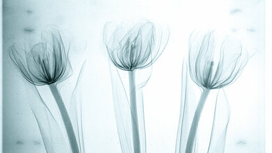 Technische und medizinische Störstrukturen im digitalen Mammogramm