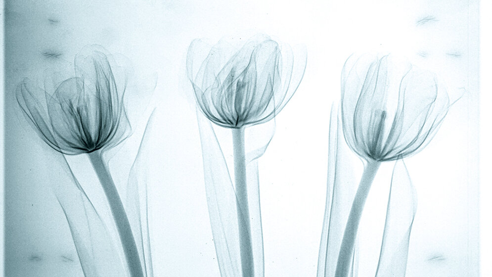 Technische und medizinische Störstrukturen im digitalen Mammogramm