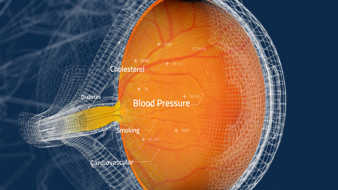 Schematischer Schnitt durch das Auge 