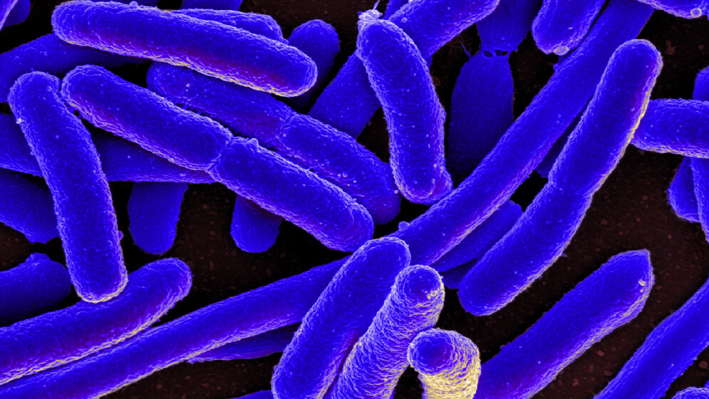 Escherichia coli-Bakterium 
