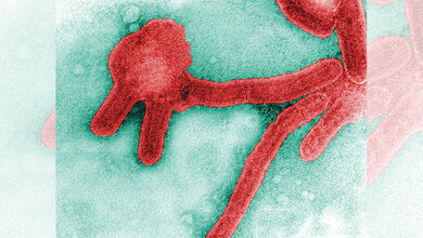 Marburg_Virus_01.jpg Marburg-Virus