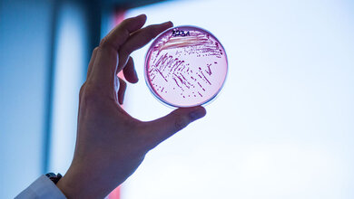 Selektivagarplatte_auf_der_ein_multiresistenter_Escherichia_coli_Stamm_waechst_Foto_JLU_Katrina_Friese.jpg multiresistenter Escherichia coli-Stamm