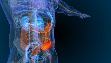 Vorscreening_Darmkrebs.jpg Vorscreening_Darmkrebs.jpg