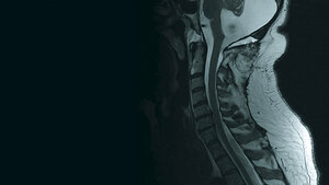 Schnittbilddiagnostik der Wirbelsäule (7.31)