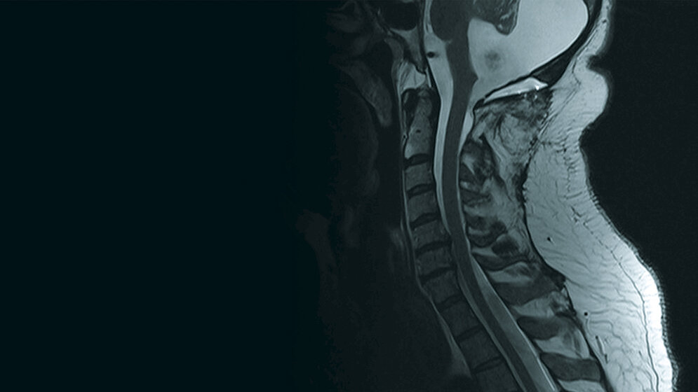 Schnittbilddiagnostik der Wirbelsäule (7.31)