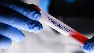 Corona_H_Ko_stock_adobe_com.jpg SARS-CoV-2 bindende Antikörper