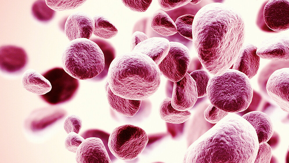 Hämatologie Diskrepante Erythrozyten-Antigen-Bestimmung bei Patienten mit Vortransfusion