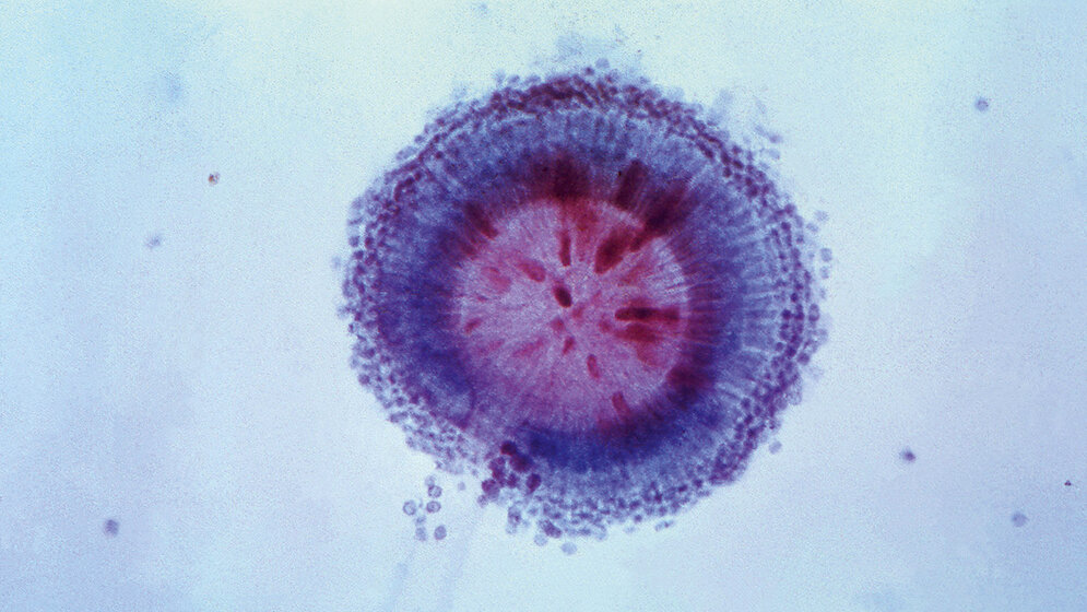 Schimmelpilze Teil 2: Aspergillus